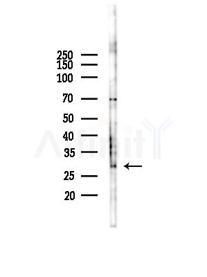 VAPB Antibody - Western blot analysis of lysates from COLO205 cells(UV,30min treatment), using VAPB Antibody at 1/1000 dilution.