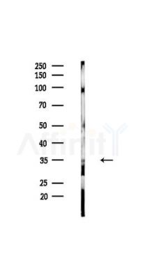 AZGP1 Antibody - Western blot analysis of lysates from HUVEC cells(UV,30min treatment), using AZGP1 Antibody at 1/1000 dilution.