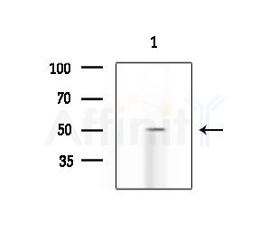 CHRM5 Antibody - Western blot analysis of extracts from EC304 cells, using CHRM5 Antibody at 1/1000 dilution.