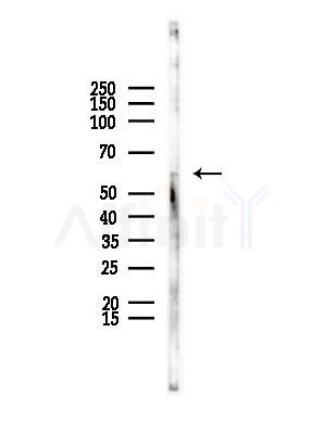 CHRM5 Antibody - Western blot analysis of lysates from EC304 cells, using CHRM5 Antibody at 1/1000 dilution.