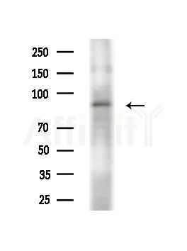 CUL5 Antibody - Western blot analysis of extracts from Hela cells(heat-shock,45min treatment), using CUL5 Antibody at 1/1000 dilution.
