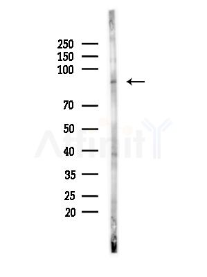 CUL5 Antibody - Western blot analysis of lysates from Hela cells(heat-shock,45min treatment), using CUL5 Antibody at 1/1000 dilution.