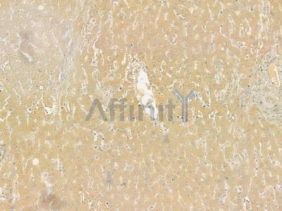CUL5 Antibody - DF7306 at 1/100 staining human normal liver tissue by IHC-P.