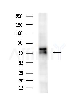 GFRA1 Antibody - Western blot analysis of extracts from MCF7 cells(heat-shock,45min treatment), using GFRA1 Antibody at 1/1000 dilution.