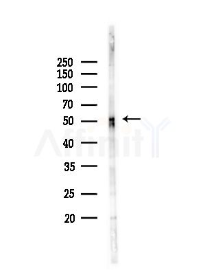 GFRA1 Antibody - Western blot analysis of lysates from MCF7 cells(heat-shock,45min treatment), using GFRA1 Antibody at 1/1000 dilution.