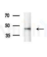 PSMC6 Antibody - Western blot analysis of extracts from Rat lung, using PSMC6 Antibody at 1/1000 dilution.