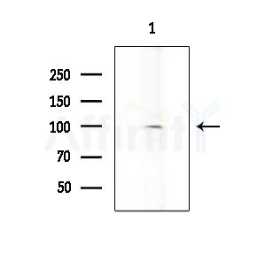 ADAM9 Antibody - Western blot analysis of extracts from K562 cells, using ADAM9 Antibody at 1/1000 dilution.