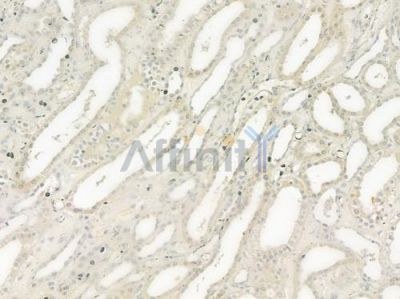 ADAM9 Antibody - DF7318 at 1/100 staining human normal kidney tissue by IHC-P.