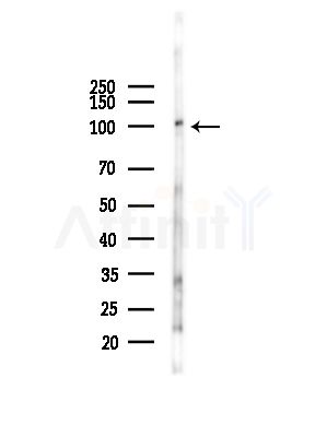 AP2A2 Antibody - Western blot analysis of lysates from RAW264.