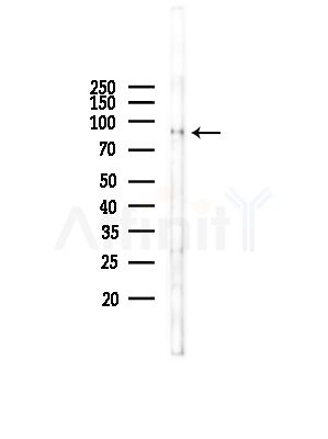 AP2A2 Antibody - Western blot analysis of lysates from Rat liver, using AP2A2 Antibody at 1/1000 dilution.