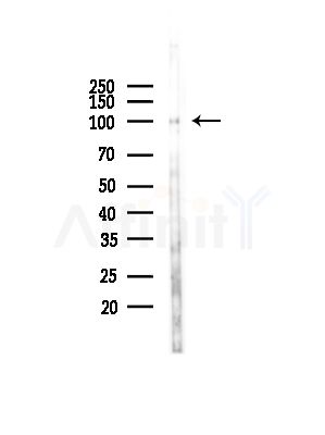 AP2A2 Antibody - Western blot analysis of lysates from COLO205 cells(UV,30min treatment), using AP2A2 Antibody at 1/1000 dilution.