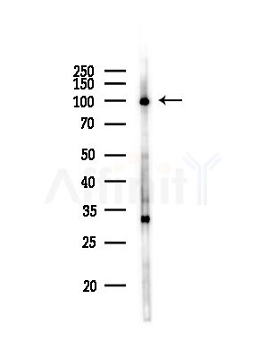 AP2A2 Antibody - Western blot analysis of lysates from Mouse lung, using AP2A2 Antibody at 1/1000 dilution.