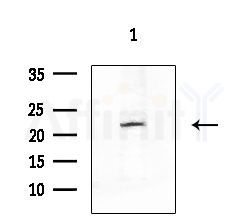 CYB5 Antibody - Western blot analysis of extracts from COLO205 cells, using CYB5 Antibody at 1/1000 dilution.