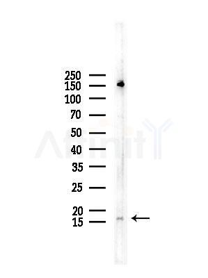 CYB5 Antibody - Western blot analysis of lysates from COLO205 cells, using CYB5 Antibody at 1/1000 dilution.