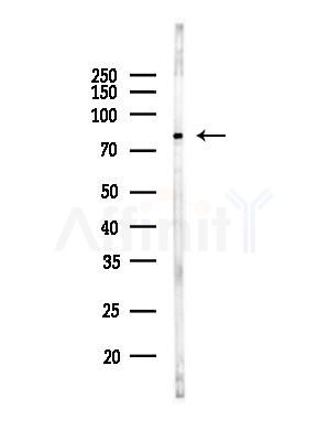 eEF2K Antibody - Western blot analysis of lysates from K562 cells, using eEF2K Antibody at 1/1000 dilution.