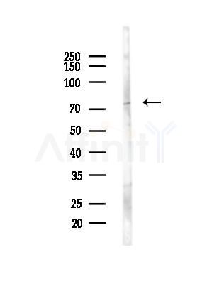 NDC80 Antibody - Western blot analysis of lysates from EC304 cells(heat-shock,45min treatment), using NDC80 Antibody at 1/1000 dilution.