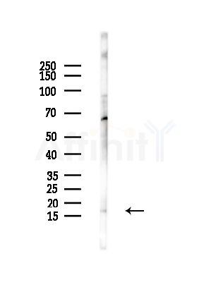 NDUFA13 Antibody - Western blot analysis of lysates from 293 cells, using NDUFA13 Antibody at 1/1000 dilution.