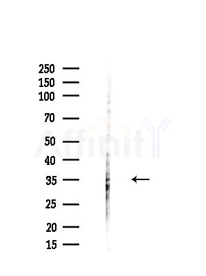 PRKRA Antibody - Western blot analysis of lysates from HUVEC cells(starvation,24h treatment), using PRKRA Antibody at 1/1000 dilution.