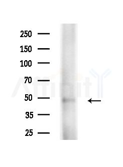 SERPINB3 Antibody - Western blot analysis of extracts from Rat liver, using SERPINB3 Antibody at 1/1000 dilution.