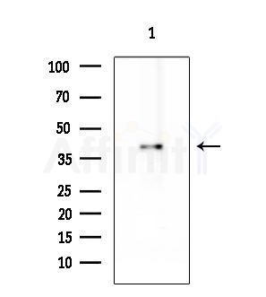 TFDP1 Antibody - Western blot analysis of extracts from EC304 cells, using TFDP1 Antibody at 1/1000 dilution.