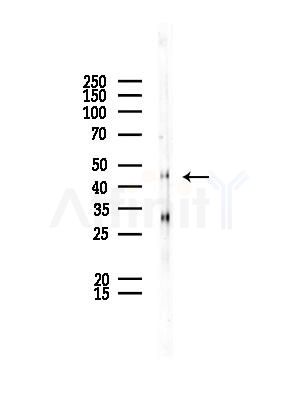 TFDP1 Antibody - Western blot analysis of lysates from EC304 cells, using TFDP1 Antibody at 1/1000 dilution.