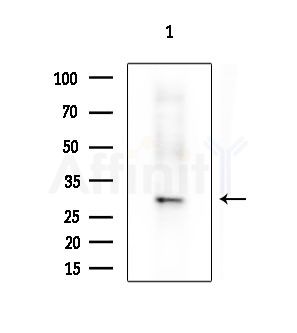 NQO2 Antibody - Western blot analysis of extracts from Rat liver, using NQO2 Antibody at 1/1000 dilution.