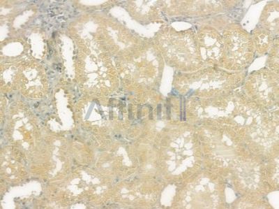 MERTK Antibody - DF7344 at 1/100 staining human normal kidney tissue by IHC-P.