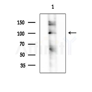 BCL11A Antibody - Western blot analysis of extracts from HepG2 cells(LPS 4h treatment), using BCL11A Antibody at 1/1000 dilution.