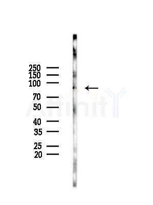 BCL11A Antibody - Western blot analysis of lysates from HepG2 cells(LPS,4h treatment), using BCL11A Antibody at 1/1000 dilution.