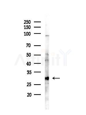 CBR1 Antibody - Western blot analysis of lysates from HUVEC cells(starvation,24h treatment), using CBR1 Antibody at 1/1000 dilution.