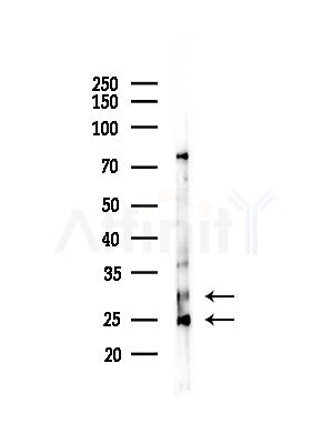 CBR1 Antibody - Western blot analysis of lysates from Hela cells(heat-shock,45min treatment), using CBR1 Antibody at 1/1000 dilution.