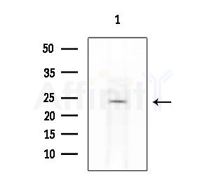 APRT Antibody - Western blot analysis of lysates from Rat liver, using APRT Antibody at 1/1000 dilution.