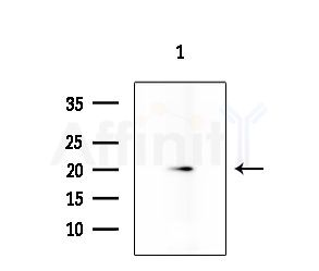 APRT Antibody - Western blot analysis of lysates from K562 cells, using APRT Antibody at 1/1000 dilution.
