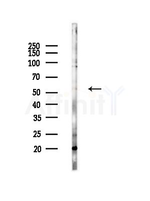 GALNS Antibody - Western blot analysis of lysates from RAW264.