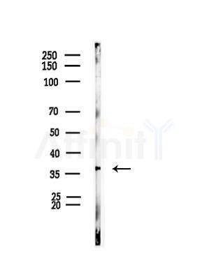 HIF1AN Antibody - Western blot analysis of lysates from EC304 cells(heat-shock, 45min treatment), using HIF1AN Antibody at 1/1000 dilution.