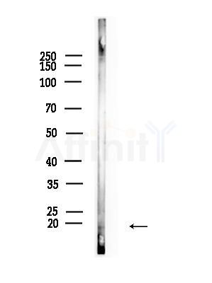 LITAF Antibody - Western blot analysis of lysates from Mouse liver, using LITAF Antibody at 1/1000 dilution.