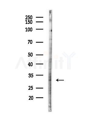 Otx2 Antibody - Western blot analysis of lysates from Hela cells(LPS,4h treatment), using Otx2 Antibody at 1/1000 dilution.