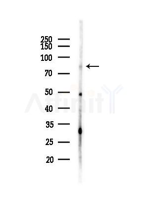 PRPF3 Antibody - Western blot analysis of lysates from MDA-MB-231 cells(heat-shock,45min treatment), using PRPF3 Antibody at 1/1000 dilution.