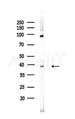 RFC4 Antibody - Western blot analysis of lysates from COLO205 cells(UV,30min treatment), using RFC4 Antibody at 1/1000 dilution.