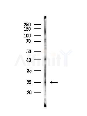 UBD Antibody - Western blot analysis of lysates from B16F10-LUC cells(heat-shock,45min treatment), using UBD Antibody at 1/1000 dilution.