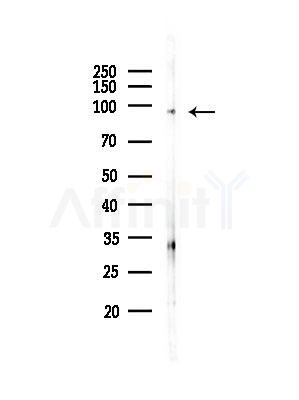 Villin1 Antibody - Western blot analysis of lysates from PC12 cells(heat-shock,45min treatment), using Villin1 Antibody at 1/1000 dilution.