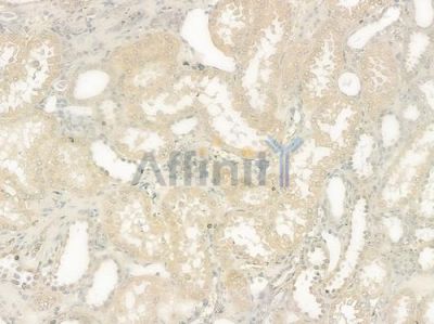 Villin1 Antibody - DF7375 at 1/100 staining human normal kidney tissue by IHC-P.