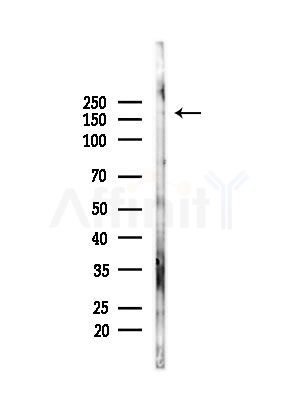 Dnmt1 Antibody - Western blot analysis of lysates from Mouse brain, using Dnmt1 Antibody at 1/1000 dilution.