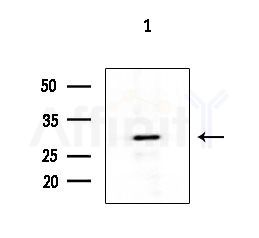 IL27A Antibody - Western blot analysis of extracts from EC304 cells, using IL27A Antibody at 1/1000 dilution.