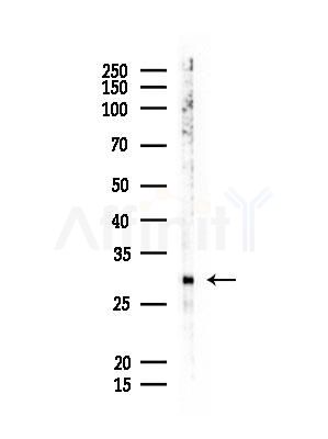 IL27A Antibody - Western blot analysis of lysates from EC304 cells, using IL27A Antibody at 1/1000 dilution.
