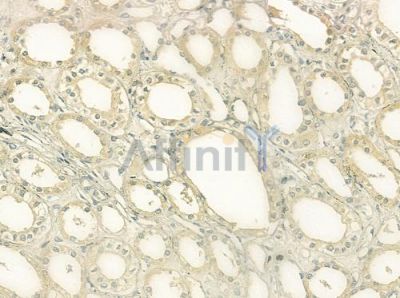 SLC3A1 Antibody - DF7379 at 1/100 staining human normal kidney tissue by IHC-P.