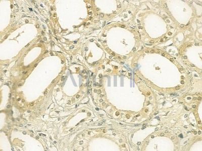 HNRNPF Antibody - DF7383 at 1/100 staining human normal kidney tissue by IHC-P.