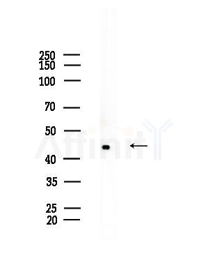 HNRNPF Antibody - Western blot analysis of lysates from EC304 cells, using HNRNPF Antibody at 1/1000 dilution.