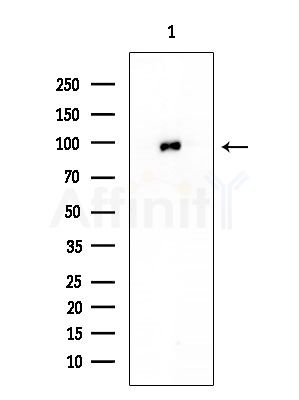 PKP2 Antibody - Western blot analysis of extracts from HUVEC cells, using PKP2 Antibody at 1/1000 dilution.