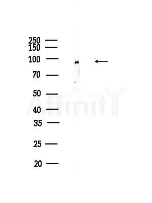 PKP2 Antibody - Western blot analysis of lysates from HUVEC cells, using PKP2 Antibody at 1/1000 dilution.